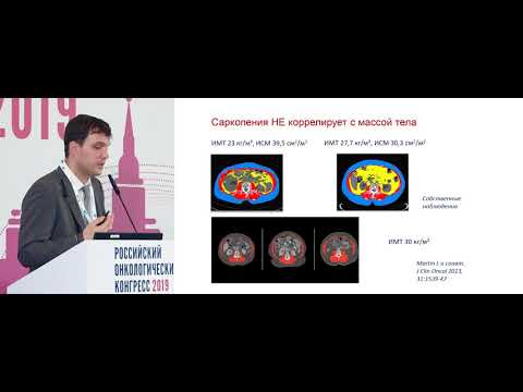 Видео: Предикторы осложнений хирургического лечения рака ободочной кишки и их клиническое применение