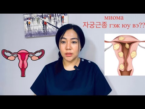 Видео: Миома гэж юу вэ?  Миомыг яагаад эмч нар тоодоггүй вэ?