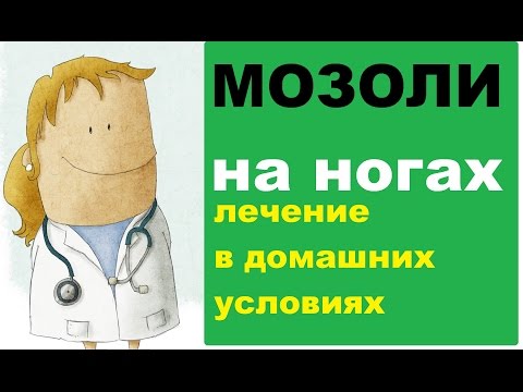 Видео: Мозоли на ногах: лечение в домашних условиях