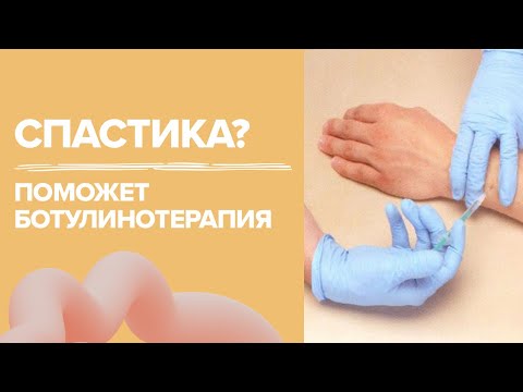 Видео: Что поможет при спастике конечностей | ботокс | ботулинотерапия | инсульт | ДЦП | ЧМТ