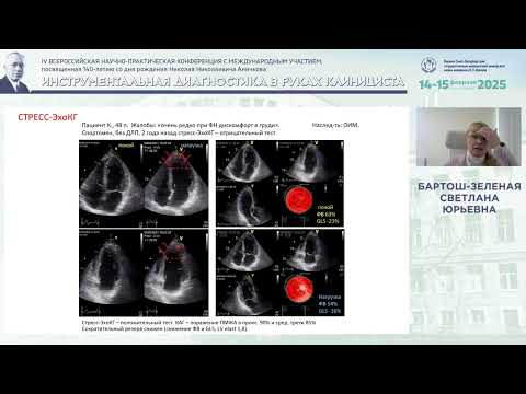 Видео: Клиническое значение деформации миокарда