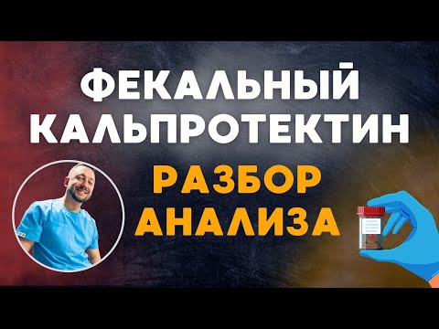 Видео: ФЕКАЛЬНЫЙ КАЛЬПРОТЕКТИН // Обследование кишечника без колоноскопии / Разбор анализа.