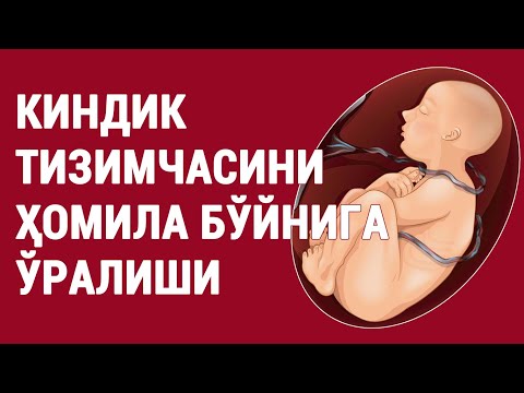 Видео: Киндик тизимчасини ҳомила бўйнига ўралиши
