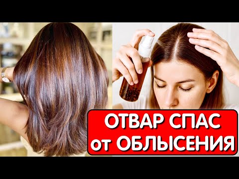 Видео: Этот ОТВАР СПАС ОТ ВЫПАДЕНИЯ ВОЛОС ! Нанесла на корни и ВОЛОСЫ РАСТУТ даже на залысинах