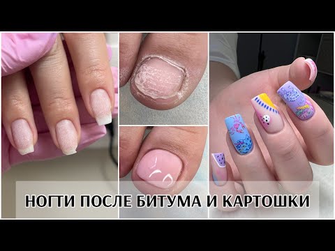 Видео: Распаковка ногтевых товаров с WB💜НОГТИ ПОСЛЕ БИТУМА И КАРТОШКИ 🫣🙄Подногтевые мозоли