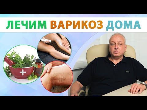 Видео: Как вылечить варикоз? Чего делать нельзя?