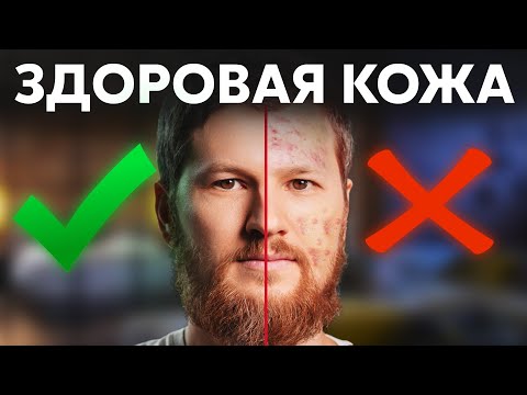 Видео: Как избавиться от ПРЫЩЕЙ? Здоровая кожа