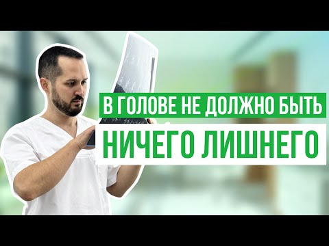 Видео: Головная боль - киста в голове