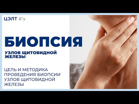 Видео: 💉 Цель и методика проведения биопсии узлов щитовидной железы. Биопсия узлов щитовидной железы. 12+