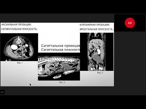 Видео: Основы КТ диагностики