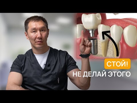 Видео: Вам НЕЛЬЗЯ ставить ИМПЛАНТЫ. Как избежать боли и потери импланта?