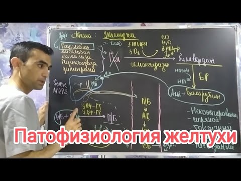 Видео: Желтухи. Нарушение билирубиного обмена.