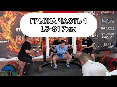 Видео: Последствия грыжи 7мм L5-S1 [ГРЫЖА ЧАСТЬ 1] Парез