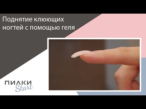 Видео: Исправление клюющих ногтей с помощью геля.  Идеальный квадрат