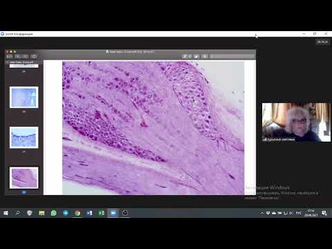 Видео: Препараты "Нервная ткань" 3к - Турыгина С.А.