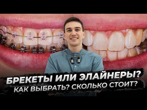Видео: Брекеты или элайнеры: как выбрать, сколько стоит?