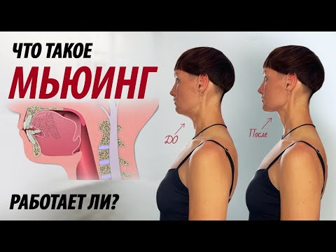 Видео: Мьюинг подтягивает овал лица. Что такое мьюинг и работает ли он?
