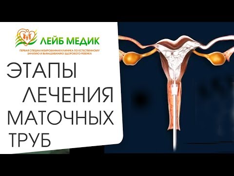 Видео: 🤰 Комплексное лечение патологий маточных труб. Лечение маточных труб. Лейб Медик. 12+