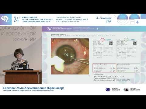Видео: SmartSight - диапазон эффективности (обзор клинических случаев)