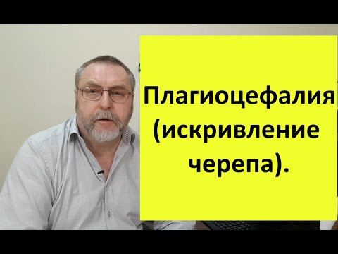 Видео: Плагиоцефалия (нарушение формы черепа). Почему возникает и что можно сделать.