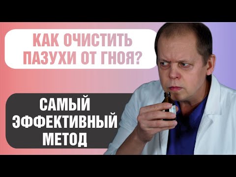 Видео: Как лечить гайморит без прокола и очистить пазухи носа?