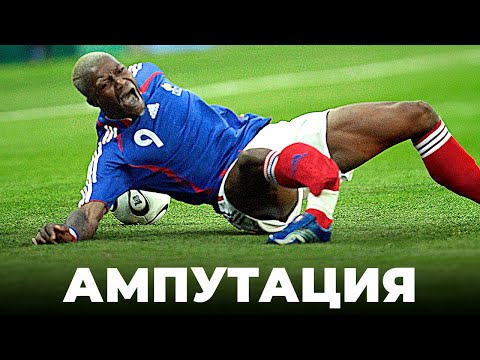 Видео: Он дважды ПРОШЕЛ ЧЕРЕЗ АД – самая СТРАШНАЯ ТРАВМА в футболе