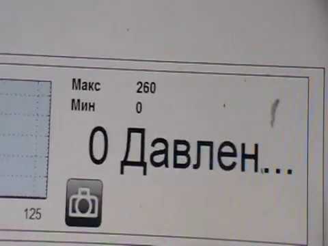 Видео: Часть 3. SsangYong Kyron. Ошибка P1254