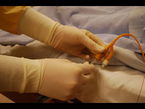 Видео: Катетеризация мочевого пузыря