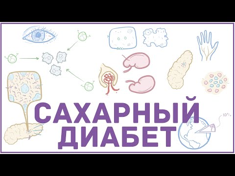 Видео: Сахарный диабет - 1 и 2 тип, причины, симптомы, кетоацидоз, гиперосмолярная гипергликемия