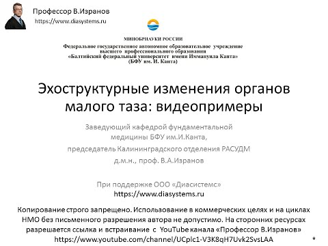 Видео: УЗИ органов малого таза у женщин: обзор видеопримеров