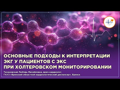 Видео: Основные подходы к интерпретации ЭКГ у пациентов с ЭКС при холтеровском мониторировании