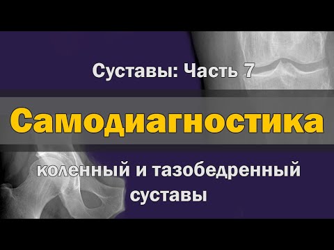 Видео: Диагностика дома - Самодиагностика коленного и тазобедренного суставов [S05E07]