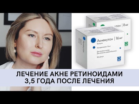 Видео: АКНЕКУТАН | ПРЫЩИ НЕ ВЕРНУЛИСЬ | 3,5 ГОДА ПОСЛЕ ОКОНЧАНИЯ ЛЕЧЕНИЯ | #акне #ретиноиды #акнекутан