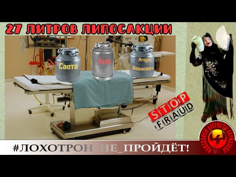 Видео: 27 литров липосакции. (Автор - Наталья Рамирес).