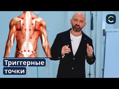 Видео: Что Такое Триггерные Точки?