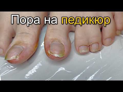Видео: Чистый педикюр Аппаратом Пошагово | Пробую салфетки 2233