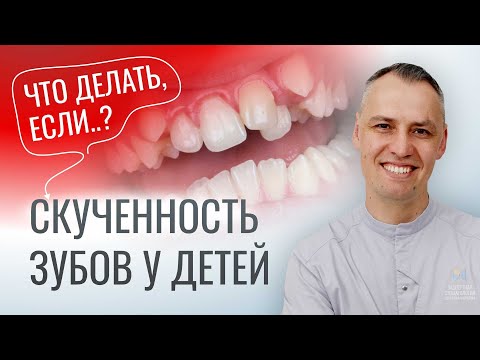 Видео: ДЕЛАЙТЕ ТАК И ЗУБЫ БУДУТ РОВНЫЕ. Вся правда про СКУЧЕННОСТЬ ЗУБОВ у детей.