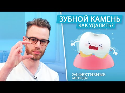 Видео: Как удалить зубной камень. Можно ли убрать в домашних условиях?