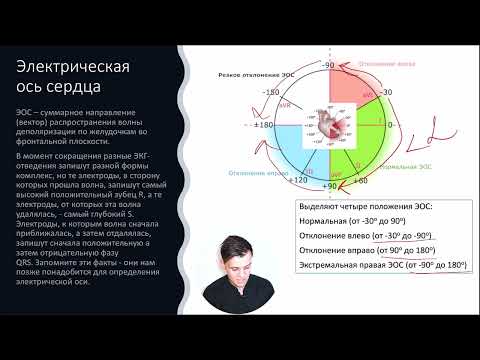 Видео: ЭКГ за 100 минут №2: Наложение электродов. Электрическая ось сердца (ЭОС)