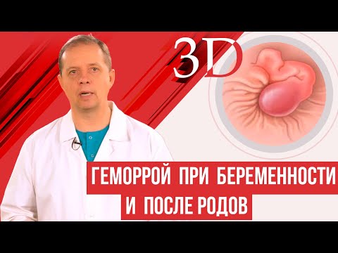 Видео: Геморрой при беременности и после родов