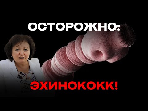 Видео: ОСТОРОЖНО: ЭХИНОКОКК!