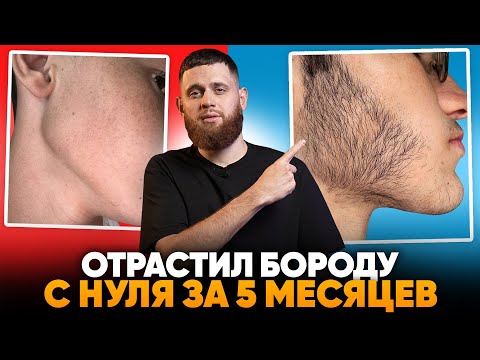 Видео: Результаты средства Mr.Volos за 5 месяцев / Отрастил бороду в 15 лет