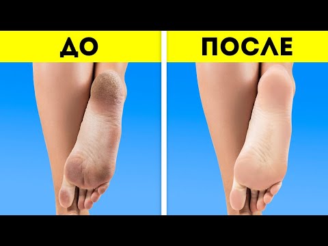 Видео: ПОЛЕЗНЫЕ СЕКРЕТЫ КРАСОТЫ || ПЕДИКЮР И УХОД ЗА СТУПНЯМИ