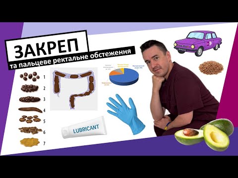 Видео: ЗАКРЕП. Причини. діагностика. Лікування. Пальцеве ректальне обстеження. #закреп #запор #дієта