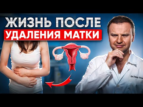 Видео: Удаление МАТКИ: что ВАЖНО знать КАЖДОЙ женщине?