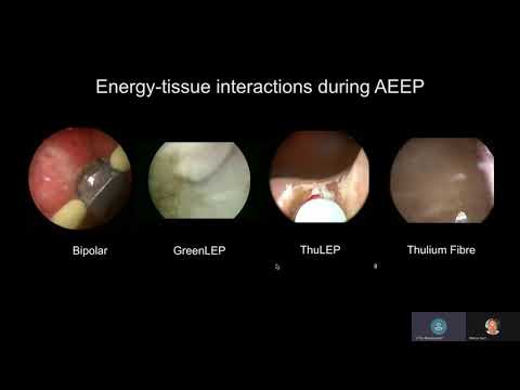 Видео: Tev Aho - MoLEP (вебинар)