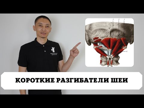Видео: Короткие разгибатели шеи. Боль в шее. Самолечение. Кинезиология