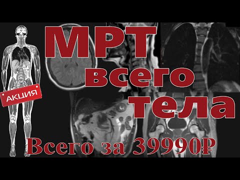 Видео: МРТ всего тела: последнее достижение или обман?