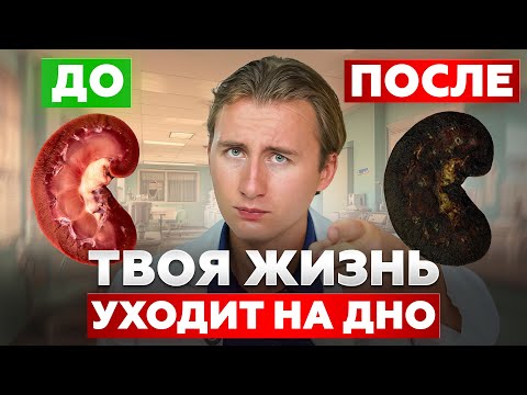 Видео: ПОКА ты просто сидишь, 94% людей погибают из-за почек! Сделай ЭТО, если не хочешь стать инвалидом!