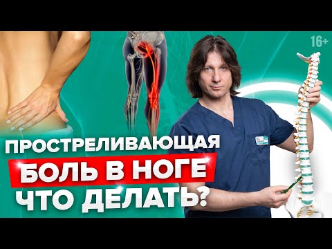 Видео: Почему боль в пояснице отдает в ногу? Как лечить защемление седалищного нерва? //16+